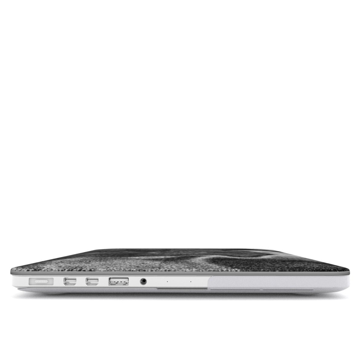 LATE MacBook Case