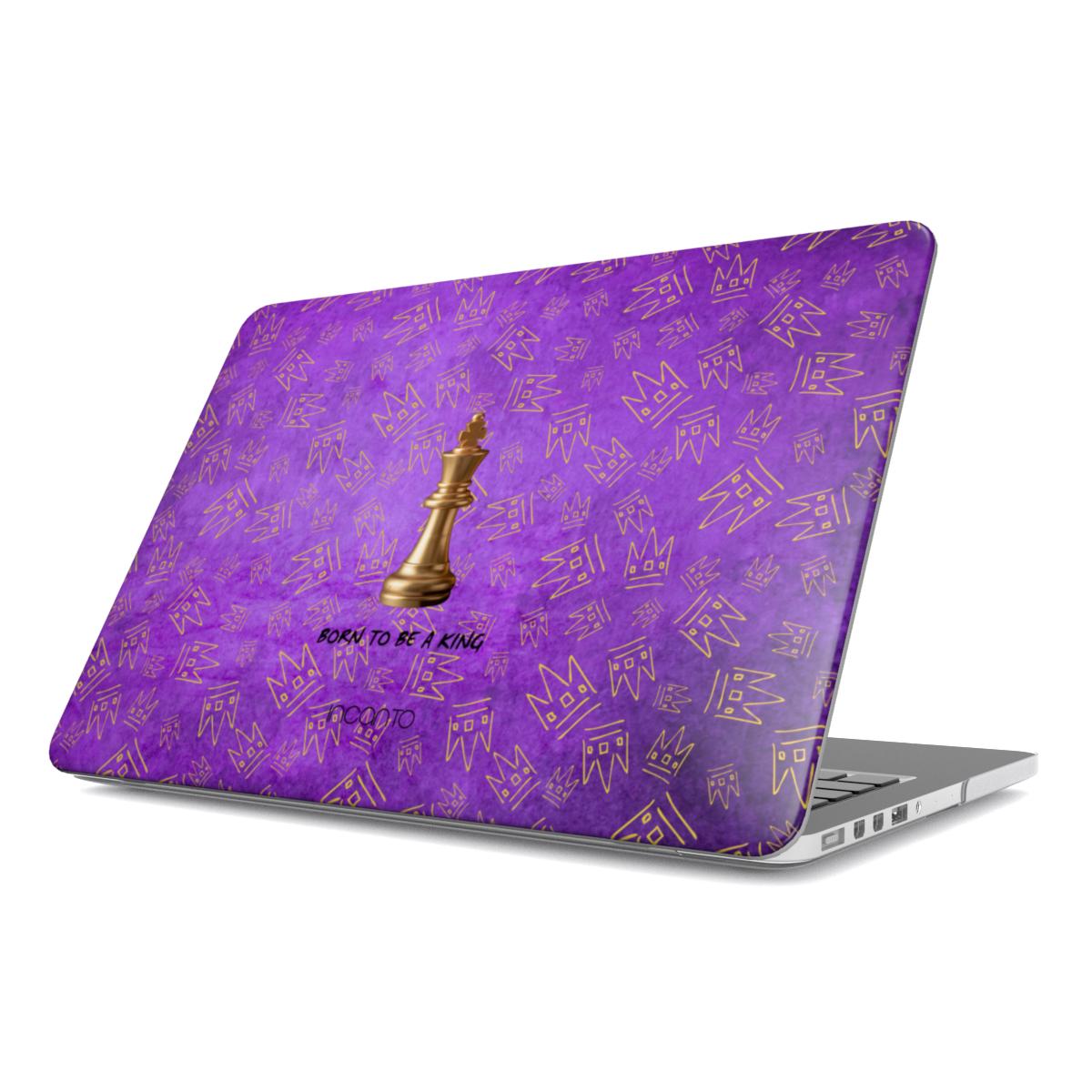 KING MacBook Case
