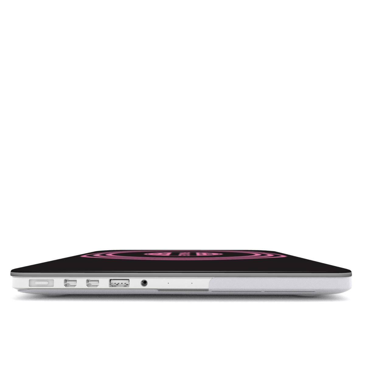 FRAGILE MacBook Case