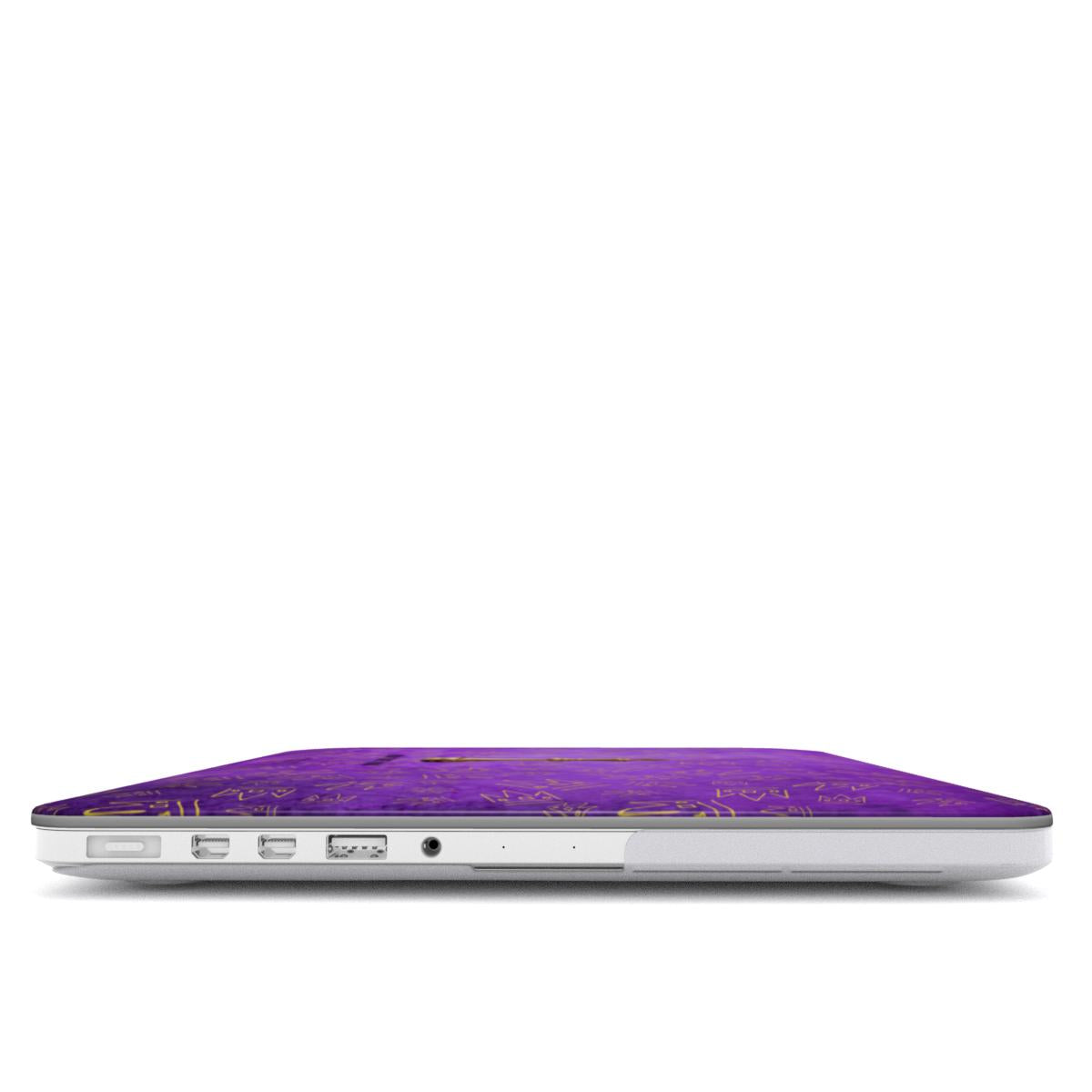 KING MacBook Case