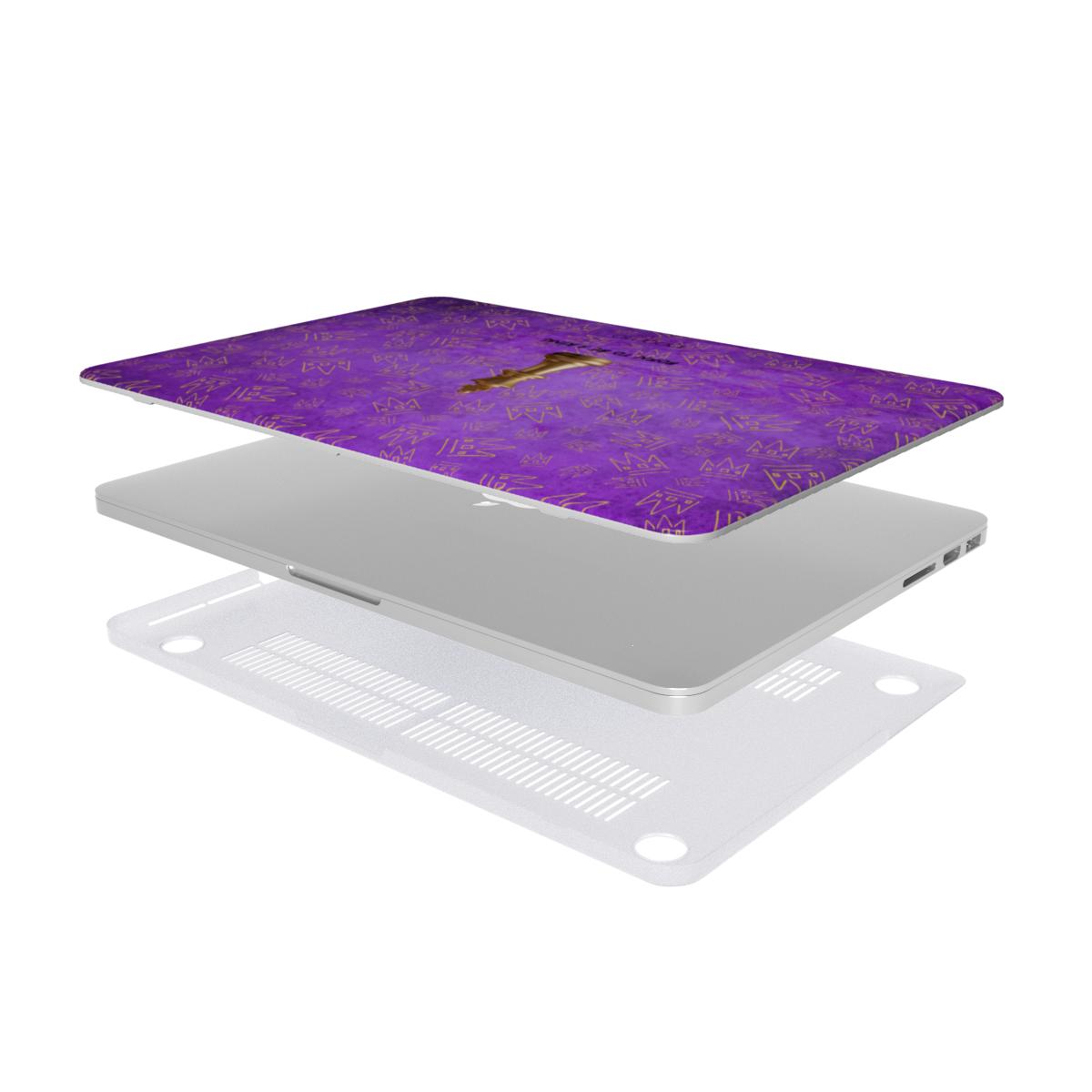 KING MacBook Case