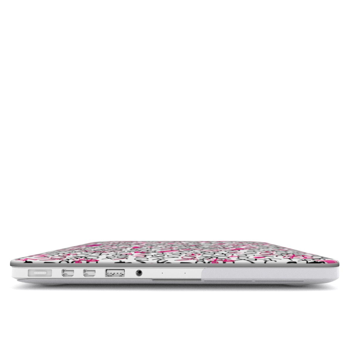 FK MacBook Case